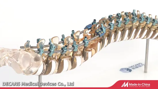 Thoracolumbar Spinal System with Cross